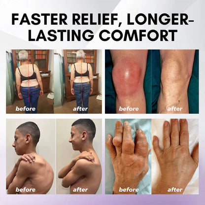 ✅ Official store: LOVILDS™ Turmeric & Emu Oil Arthritis Soothing Pain Relief Massage Gel(👨‍⚕️AAD Recommended)